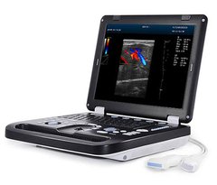Portable Ultrasound Scanner DCU30 DCU30 photo