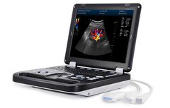 Portable Ultrasound Scanner DCU50 DCU50 photo