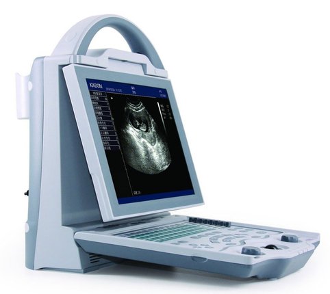 Портативний УЗД сканер для ветеринарії КХ5600 VET, KAIXIN КХ5600 фото