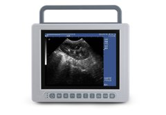 Portable Ultrasound Scanner К10 К10 photo