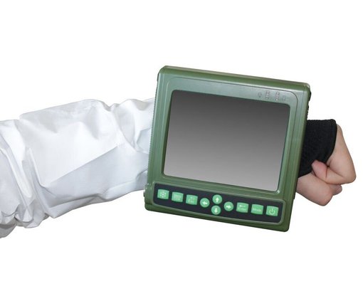Manual ultrasound scanner V1 V1 photo
